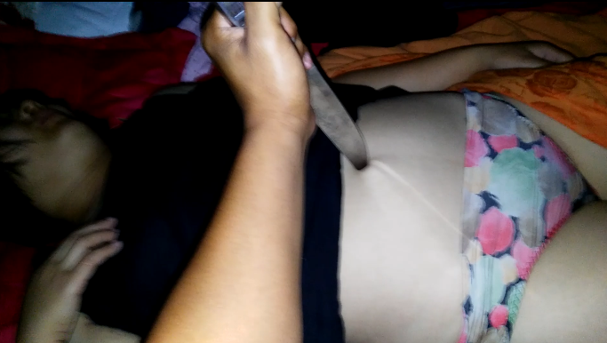 剖女友脐芯(VID_20170713_031107)