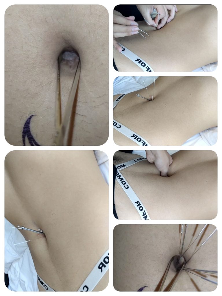 实践女友肚脐02（16分钟 露yin＋针刺）