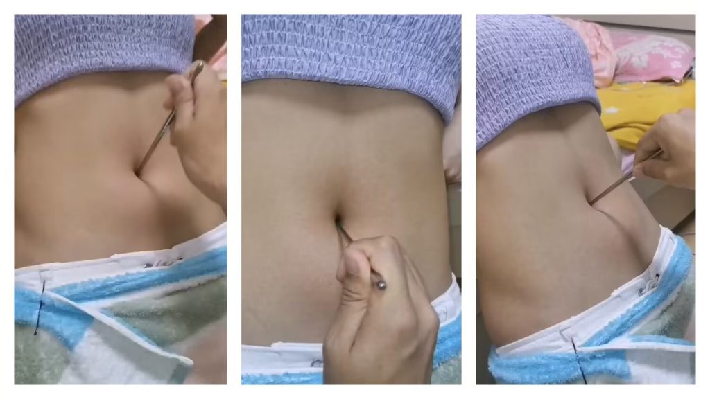 钢筷子重捅肚脐