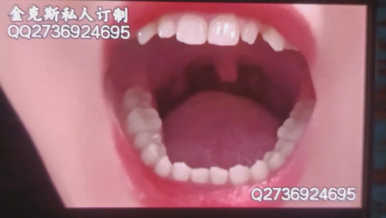 金克斯-黑丝魔女腹劫